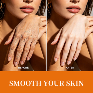 Baume réparateur pour les talons gercés, hydratation intense de haute qualité, adoucit la peau rugueuse, crème hydratante pour les mains et les pieds au miel de Manuka, stick - Product Image 2