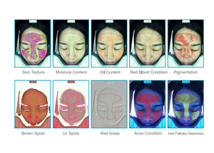 Fournitures esthétiques, analyseur de peau UV, équipement d'analyse cutanée dermatologique, spécifications pour tous les types de peau - Product Image 6
