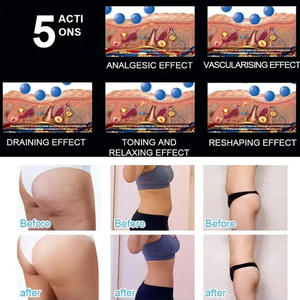 2024 chaud Vibration balle rouleau <span class=keywords><strong>Massage</strong></span> <span class=keywords><strong>Anti</strong></span> <span class=keywords><strong>Cellulite</strong></span> roulement corps minceur dispositif profond roulement <span class=keywords><strong>Massage</strong></span> réduire la graisse - Product Image 5