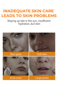 Tónico de Cúrcuma de 100 ml, Venta Caliente, para el Cuidado Facial Diario, Antiacné, Manchas Oscuras, Tónico Facial - Product Image 3