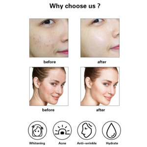 ZS DIY <span class=keywords><strong>Derma</strong></span> Modélisation Masque Poudre Hydratant Masque De Gelée Glacée Pour Rafraîchissement De La Peau Remplissage Élasticité Glow Peau Peel-Off Masque - Product Image 6