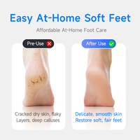 CURVY MOON Outil de pédicure professionnel rechargeable pour éliminer les peaux mortes des pieds, outil de soin des pieds, éliminateur de callosités électrique