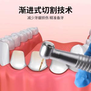 Toboom <span class=keywords><strong>BOPT</strong></span> Fresa Eléctrica Vertical para Restauración de Corona Completa FG7906, Fresa de Preparación Dental, 4 Piezas/Set, Fresas de Diamante Tipo Tambor para Clínica Dental - Product Image 4
