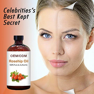 OEM <span class=keywords><strong>Huile</strong></span> <span class=keywords><strong>essentielle</strong></span> de cynorrhodon <span class=keywords><strong>Huile</strong></span> de rose musquée naturelle pure <span class=keywords><strong>Huile</strong></span> hydratante <span class=keywords><strong>anti</strong></span>-âge pour le <span class=keywords><strong>visage</strong></span> <span class=keywords><strong>Huile</strong></span> de cynorrhodon - Product Image 5