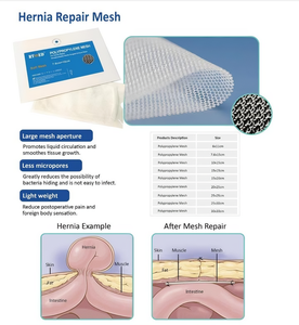 En gros Personnalisé Hôpital Médical Chirurgical De Haute Qualité Polypropylène Hernie Réparation Maille Abdominale Défaut Réparation - Product Image 6