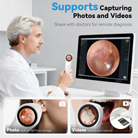 Caméra endoscopique visuelle réutilisable pour l'oreille, 3,9 mm, 4 LED, otoscope, écran de 1,28 pouce, caméra auriculaire avec écran