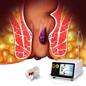 Láser anorrectal Hemorroides Fístula Diodo quirúrgico Láser 980nm 1470nm Gastroenterología Cirugía colorrectal Proctología