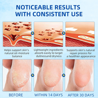 Crème pour les pieds à 60% d'urée en stick avec 2% d'acide salicylique, puissant éliminateur de callosités pour une hydratation intense et un adoucissant pour peaux mortes