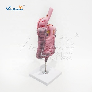 Modelo Patológico del Sistema Digestivo, Lesiones Gástricas e Intestinales, Úlcera, Cáncer, Modelo <span class=keywords><strong>de</strong></span> Enseñanza Médica - Product Image 1