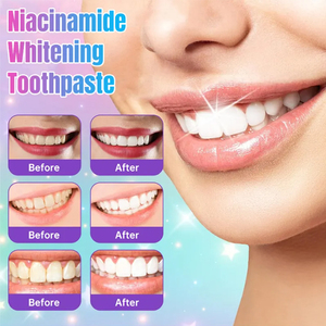 YECUCE Marque Privée <span class=keywords><strong>Dentifrice</strong></span> Herbal 100g Anti-Taches Renforce l'Émail <span class=keywords><strong>Blanchiment</strong></span> <span class=keywords><strong>des</strong></span> <span class=keywords><strong>Dents</strong></span> <span class=keywords><strong>Dentifrice</strong></span> Blanchissant à la Niacinamide - Product Image 2