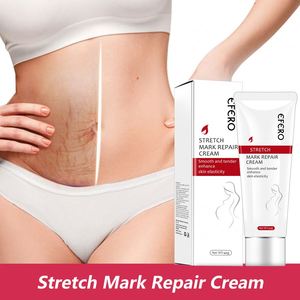 Crema per la rimozione delle smagliature antirughe con etichetta privata efficace per i marchi di gravidanza Reporiginaltch segna crema Unisex - Product Image 3