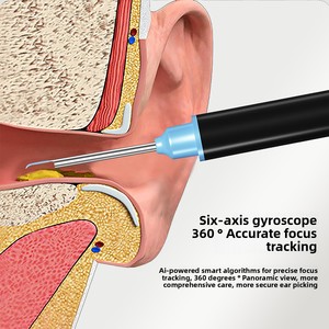 Meilleure Vente : Gadget Électronique Intelligent Sans Fil pour Nettoyage d'Oreilles, Outil Visuel d'Extraction de Cérumen avec Caméra HD, <span class=keywords><strong>Nettoyeur</strong></span> d'Oreilles Portable - Product Image 4