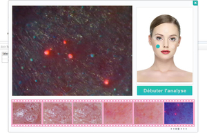 Analyseur de peau numérique portable USB pour le visage et le corps avec analyse de l'acné et de la pigmentation pour les boutiques de cosmétiques et les salons de beauté - Product Image 4