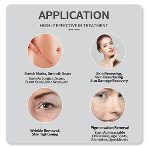 RF Fractional CO2 Laser Fotona Laser Đối Với <span class=keywords><strong>Stretch</strong></span> <span class=keywords><strong>Marks</strong></span> Scar Diệt Âm Đạo Thắt Chặt - Product Image 6