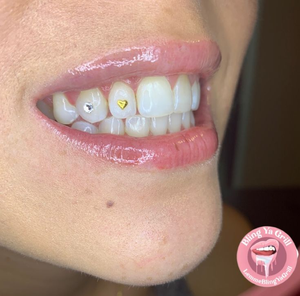Kit Profesional de Gemas Dentales de Oro, 3 Piezas/Caja, Productos de Higiene Bucal Multiusos con Luz de Curado y Pegamento - Product Image 3