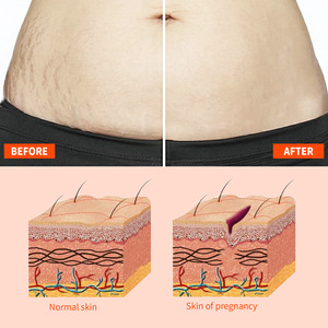 Huile réparatrice de cicatrices et éclaircissante des vergetures à la vitamine E 125 ml, hydratant nourrissant pour une peau lisse et douce, tous types de peau - Product Image 5