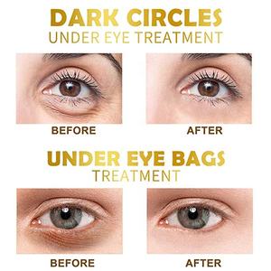 Masque oculaire à collagène d'<span class=keywords><strong>aquagel</strong></span> or pur, soins de la peau, patch pour les yeux, cercles foncés, 1 pièce - Product Image 3