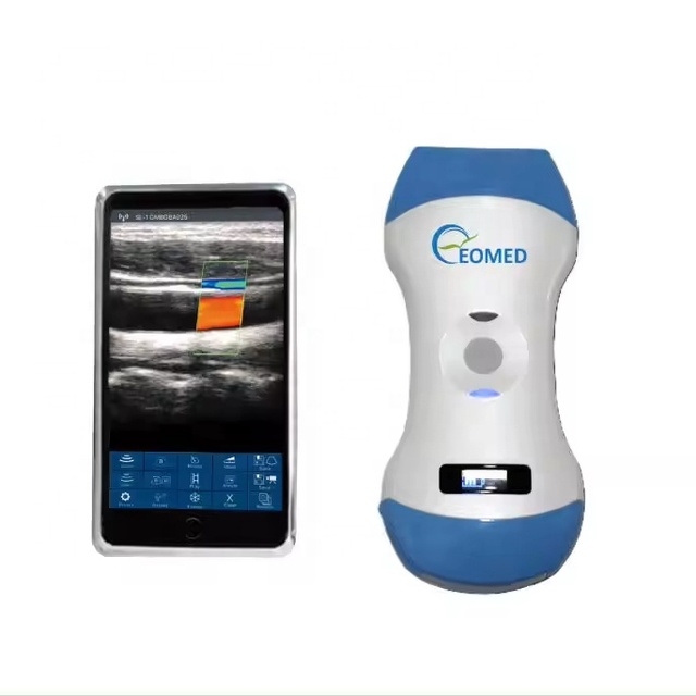 3 in 1 Portable Probe Smartphone Wifi Linear Handheld Ultrasound Doppler Medical Wireless Ultrasound Probe DCU19E