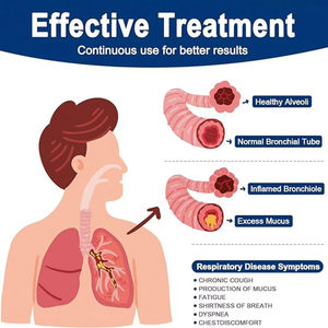 Dispositivo de Ejercicio Pulmonar Compacto, Dispositivo Portátil para la Eliminación de Mucosidad y Limpieza Pulmonar, Tamaño Compacto para los Pulmones - Product Image 2
