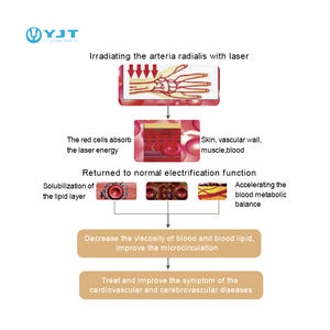 Reloj de terapia láser para purificación de sangre, <span class=keywords><strong>tratamiento</strong></span> de acupuntura de muñeca para diabetes, <span class=keywords><strong>hipertensión</strong></span>, equipo de fisioterapia - Product Image 2