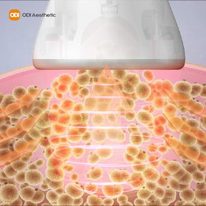Macchina per Dimagrimento Odi, Dispositivo di Pressoterapia per Drenaggio Linfatico e Riduzione della Cellulite - Product Image 3