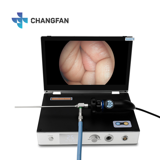 4 in 1Medical Portable Endoscope Camera All in One System USB HD 1080P 11.6 Inch Portable Monitor with Light Source