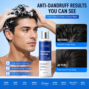 Shampoo Antiforfora a Marchio Privato con <span class=keywords><strong>Solfuro</strong></span> <span class=keywords><strong>di</strong></span> <span class=keywords><strong>Selenio</strong></span>, Shampoo Antiforfora per l'Equilibrio del Cuoio Capelluto e il Controllo del Sebo, Produttore <span class=keywords><strong>di</strong></span> Shampoo per Capelli - Product Image 1