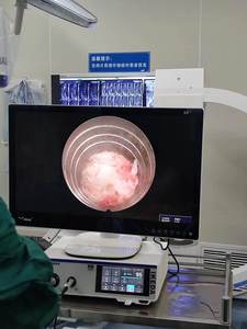 Monitor Médico IKEDA <span class=keywords><strong>YKD</strong></span>-8132 de 32 Pulgadas, 4K UHD, Pantalla de Imagenología para Endoscopia de Grado Quirúrgico - Product Image 6