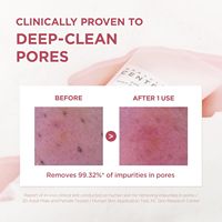 Skin1004 Poremizing Deep Cleansing Foam Makeup Remover, Korean Face Cleanser with Himalayan Salt Korean Skin Care in Stock