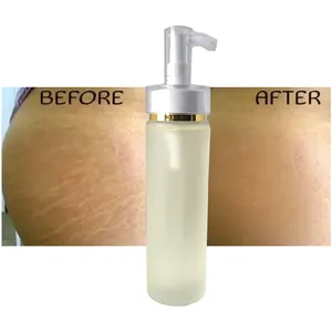 Stretch Marks Removal Oil Whitens naturally for scars and stretch marks