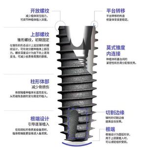 Implantes Dentales DIO UFIII/UFII de Alta Calidad para Aplicaciones Hospitalarias, al Mejor Precio, Hechos en Corea - Product Image 6