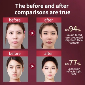Outil professionnel de raffermissement du visage, réducteur de visage en V et masseur de contour du menton pour le lifting et le raffermissement du visage - Product Image 2