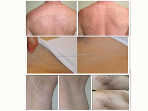 2025 Diode professionnelle DPL/IPL Laser <span class=keywords><strong>épilation</strong></span> rajeunissement de la peau acné HR pièce à main unique dispositif de SALON de <span class=keywords><strong>lumière</strong></span> d'impulsion intense - Product Image 6