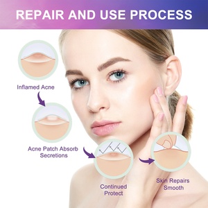 Patchs Hydrocolloïdes Scintillants Anti-Points Noirs et Imperfections pour le Visage et la Peau, Marque Privée - Product Image 4