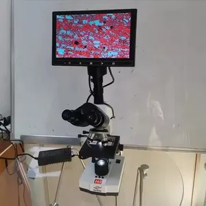 Microscópio Biológico Bd-Ydx2002-D1 com LCD para Pesquisa ou Análise de Células Sanguíneas Vivas - Product Image 3