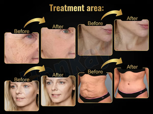 2 in 1 Hiifu 7d wrinkle removal anti aging <b>Machine</b> Skin Tightening Face Lifting <b>Machine</b> - Product Image 5