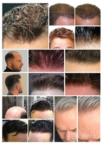 <span class=keywords><strong>Parrucca</strong></span> da <span class=keywords><strong>uomo</strong></span> modello P2-3-8, capelli a filo singolo con NPU, capelli indiani, onda naturale, 6 pollici di lunghezza, densità 120%, cuciture invisibili, sostituzione. - Product Image 3
