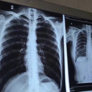 ฟิล์มสัตว์เลี้ยงกันน้ำปรับแต่งได้สำหรับ Epson/OKI/fuji/xerox pr-ct CR DR A4/A3/8x1 0/14X17ขนาด - Product Image 5