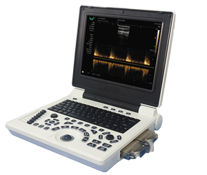 Prix plus bas pour les instruments d'échographie médicale, scanner d'échographie, échographie portable, prix de vente en gros - Product Image 6