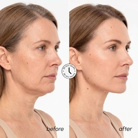 Masque liftant V-Line PINNSKIN Or 24K Collagène Rétinol Acide Hyaluronique pour le visage et le cou, raffermissant et remodelant, avec sangle de maintien du menton, format voyage, OEM