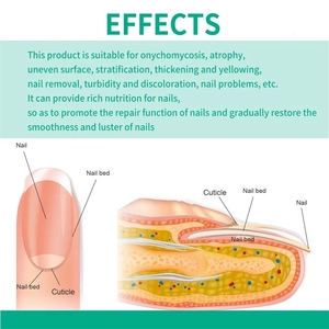 Rganic-Herramienta de reparación de uñas, accesorio para uñas de diferentes colores - Product Image 3