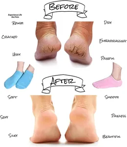2025 Reparación y suavización de Pies secos agrietados Skins <span class=keywords><strong>Gel</strong></span> Spa Calcetines <span class=keywords><strong>Gel</strong></span> hidratante suave Calcetines hidratantes - Product Image 2