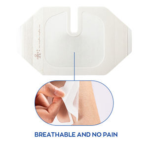 कारखाने का ओम डिस्पोजेबल चिकित्सा स्टेरिल कैथिटर जलसेक उपचार घाव की देखभाल pviv पारदर्शी ड्रेसिंग - Product Image 4