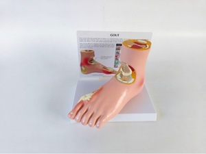 Modè<span class=keywords><strong>le</strong></span> de pied pathologique en PVC de marque Yulin pour la communication avec <span class=keywords><strong>les</strong></span> patients, pour la goutte, <span class=keywords><strong>les</strong></span> complications, l'arthrite, l'articulation du pied <span class=keywords><strong>et</strong></span> de la cheville - Product Image 5