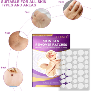 ELAIMEI Custom Logo <strong>Skin</strong> <strong>Tag</strong> <strong>Remover</strong> <strong>Patches</strong> 144pcs OEM Service Natural Herbal Acne &amp; Wart Removal Pain Free Fast Acting Factory - Product Image 4