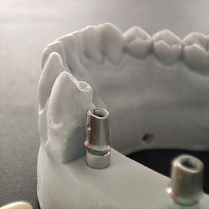3d Printer Hybride Zirkonia Kronen En Brug Tandheelkundige Implantaat Met Titanium <span class=keywords><strong>Abutment</strong></span> - Product Image 3
