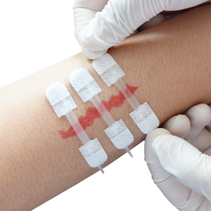 6cm x 8cm Zip Stiches plaie peau fermeture bande dispositif Transparent pansement Steri bandes plaie fermeture dispositif - Product Image 5