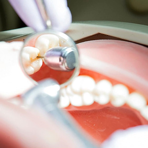 Espejo Bucal Dental de Acero Inoxidable a Precio Económico, Instrumentos Dentales, Espejo de Inspección Dental Profesional para Uso Odontológico en Venta - Product Image 3