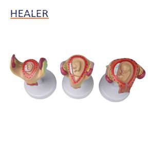 Mô hình sinh sản khoa học y tế Mô hình giải phẫu nữ cho sự phát triển của phôi thai và tử cung của thai nhi - Product Image 3