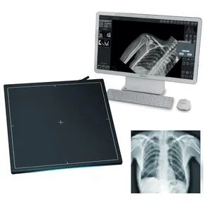 Detektor Panel Datar DR Sinar X Digital 17*17 "Kabel Medis untuk Radiografi Diagnostik Manusia/Hewan